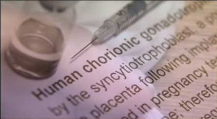 human chorionic gonadotropin - image of HCG